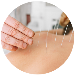 Acupuncture-therapy-slider-1