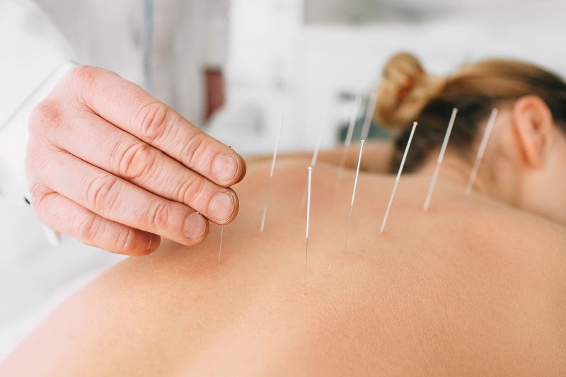 Acupuncture-therapy-treatment