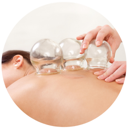 Cupping-therapy-slider